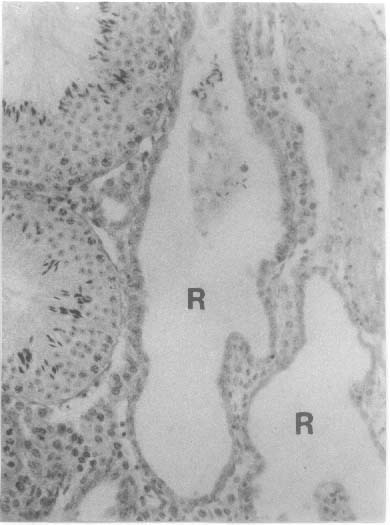 Stains for albuginea cysts