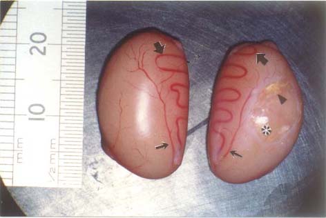 testis layers