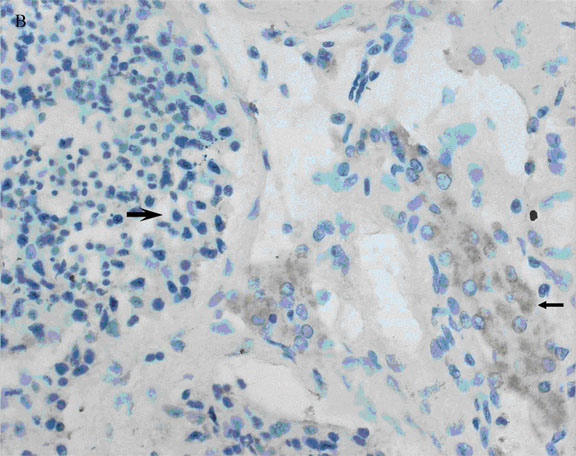 3B (normal testis): Strong hybridization signal found only in Leydig cells 